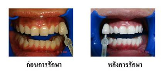 cosmetic-dentistry2